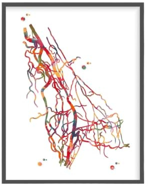 1 St Kardiologi Vaskulär Sys Affisch Angiogram Anatomi Angiologi Medicinsk Kirurgi Dukmålning Väggkonst Klinik Heminredning(13,40x60cm Unframed)