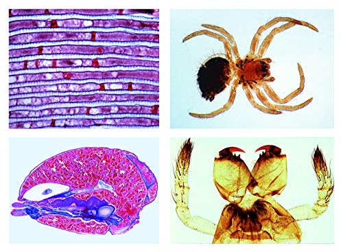 LIEDER Mikropräparat Serie: Spinnentiere und Tausendfüßler (Arachnoidea, Myriapoda), neue erweiterte Serie, 12 Präparate