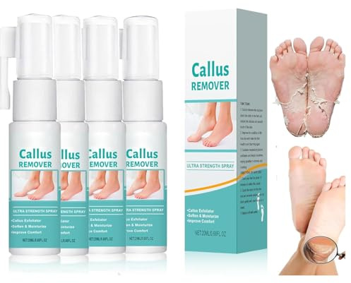 Fuß-Hornhautentfernungsspray für Fersenschwielen, Professioneller Hornhautentferner Fuß, Hornhautreduzierspray, Hornhautweicher Spray, Fuß-Peeling-Spray, Hornhaut Entfernen Fuß (4)