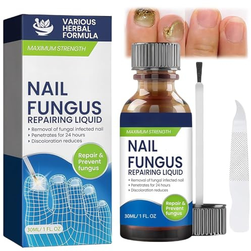 Nail Fungus Treatment for Toenail,Fungal Nail Treatment Extra Strong Toenail Fungus Treatment Nail Repair Growth Treatment Nail Softener for Thick Toenails Toe and Finger Nail Solution 30ML