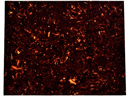 dopro 25 x 20 cm Akustische Gitarre Selbstklebende Schlagbrett DarkTortoise