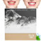 Underbrush Remineralizing Chewing Gum,Remineralizing Gum,Mastic mints Teeth Cleaning Gum,Remineralizing Chewing Gum,Mint Teeth Cleaning Gum,Organic Portable Teeth Cleaning Gum,Long Lasting Chewing Gum