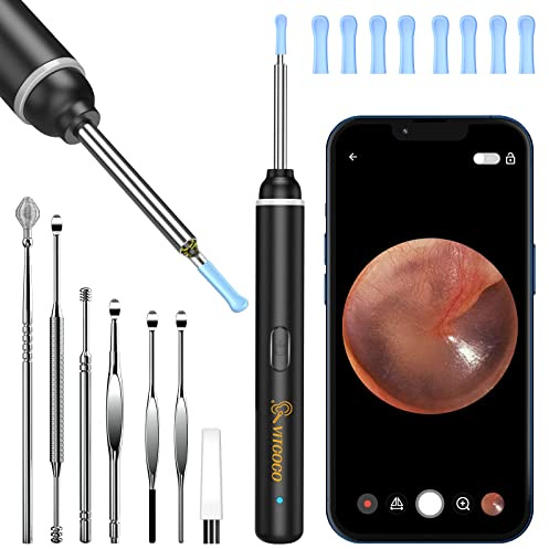 VITCOCO Otoscopio Digitale 1920P HD, con 6 Luci LED e 3,5mm Lente Impermeabile, per Pulizia Orecchie Sicura, Compatibile con iPhone, iPad, Smartphone Android e App Dedicata (Nero)
