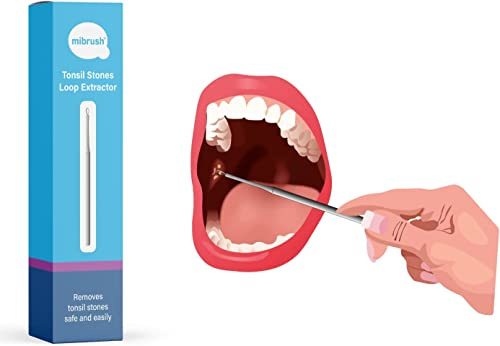 MiBrush Tonsil Stones Loop Extractor | Entfernung von Mandelsteinen - Edelstahl - Frischer Atem - Gesunde Mandeln