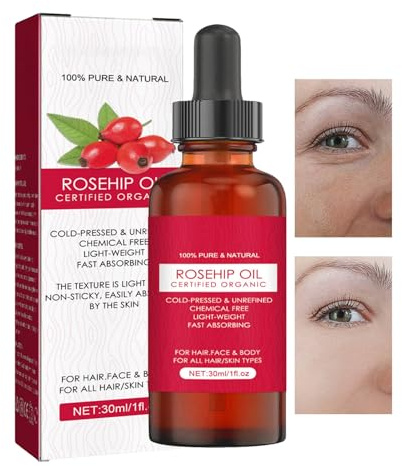 PEKMAR Rosa mosqueta orgánico - semilla Rosa mosqueta Natural Puro para la Cara - Aceite Facial hidratante 30 ml para Rostro, Cuerpo, Aceite para el Cuidado la Piel