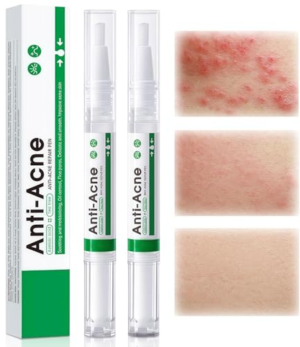 2xClear Pickelstift mit Teebaumöl - Anti Pickel Gel für frühe Akne,leicht einziehende Formel mit Präzisions for Skin Care