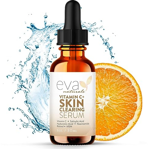 Eva Naturals Vitamin C Serum for Face – Skin Clearing Treatment with Retinol, Niacinamide & Natural Extracts – Fades Dark Spots, Fights Acne & Improves Radiance (30 mL)