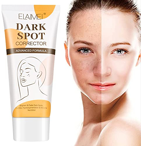 Sommersprossen Creme, Aufhellende Creme, Flecken Creme, Altersflecken Creme, Pigmentflecken Entferner, Altersflecken- und Sommersprossenentferner, Dunkle Flecken Aufhellen und Verblassen-60ml