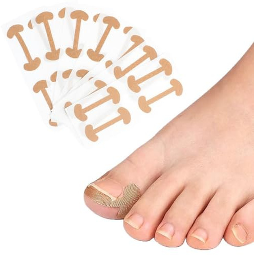KIRZAX Set di 100 pezzi Kit per la correzione delle unghie dei piedi endogene, Sollevatore di unghie incarnite, Sticker per unghie dei piedi in cotone elastico, Strumento per la pedicure