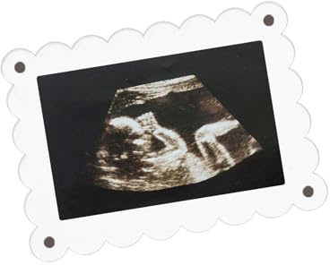 Tinoaly 2stk Magnetischer Bilderrahmen Acryl, 12,7x17,78cm Transparent Ultraschall Bilderrahmen zur Anzeige von Schwangerschaftsankündigungen und Bekanntgabe des Geschlechts