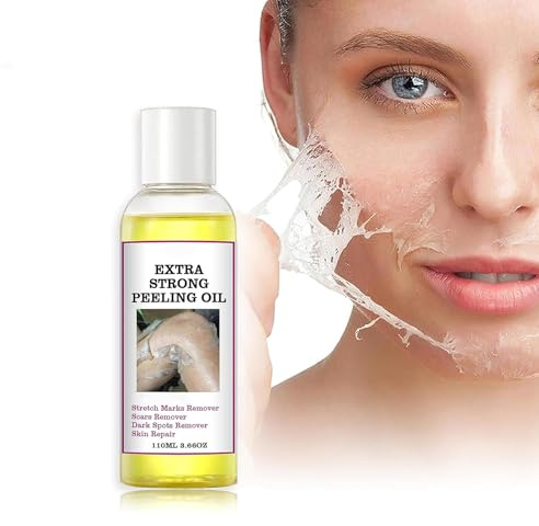 Yellow Peeling Oil, Peeling Oil for Dark Skin, Strong Peeling Gel Extra Strength, Exfoliating Peeling Solution for Body All Skin Type Dead Skin Remover (3.87 Fl Oz / 110ML)