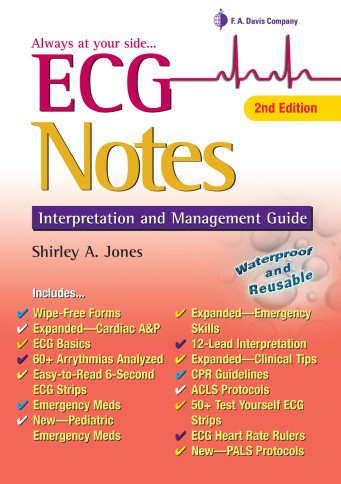 ECG Notes: Interpretation and Management Guide