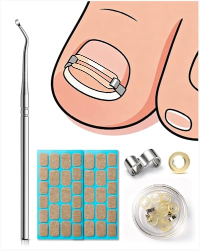BEZOX Corrector de uñas encarnadas, fácil aplicación en casa