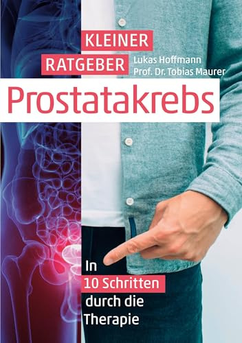 Kleiner Ratgeber Prostatakrebs: In 10 Schritten durch die Therapie