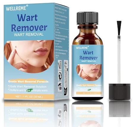 Wart Remover, Fast-Acting Skin Tag Removal Kit Care for Wart Removal on Hands and Body, Suitable for Various Skin Types (30ml)