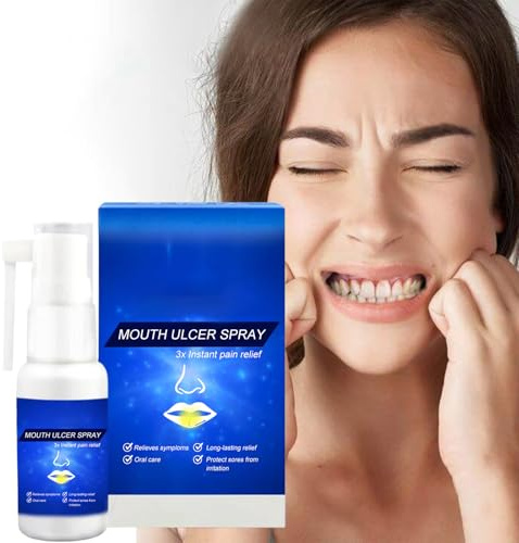 Spray per Denti Gengive, 30ml Spray Analgesici Dentali,Sprays per Alleviare Mal Denti,Sprays Contro Mal Di Denti