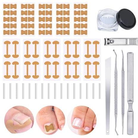 16PCS Set Correttore per Unghie Incarnite Cerotti per Unghie Incarnite Piedi Tagliaunghie Attrezzi per Pedicure Strumenti per Unghie Incarnite Kit