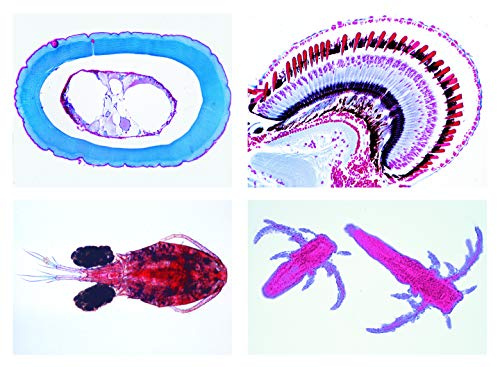 LIEDER Biologie Mikroskopie Mikropräparate Serien: Krebstiere (Crustacea), 10 Präparate