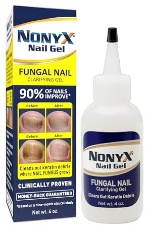 NONYX Fungal Nail Clarifying Gel | Clinically Proven for Discolored, Thick, Brittle, Yellow, Lifted, and other signs of Fungus-Damaged Toenails | 90% of Nails Improve | Over 8 million sold