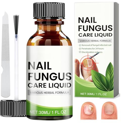 Nagelpflege für Fußnägel, Nail Repair, Schutz & Stärkung brüchiger Nägel, Nagelpflege Pflegend, Nagelpflegeöl, Nail Care, Fußnägel Behandlung mit Nagelfeile, 30ml