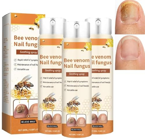 FungiBee Spray avanzato per la riparazione delle unghie, spray lenitivo al veleno d'api contro i funghi delle unghie, estratti di ingredienti naturali, delicato ed efficace (3pcs)