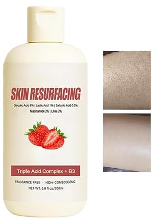 YNPQTDS Crème de Soin à la Fraise | 200ml Crème Hydratante Visage pour Peau Grumeleuse - Lotion Corporelle Adoucissante pour Cou Bras Jambes et Visage Jour Voyage Quotidien