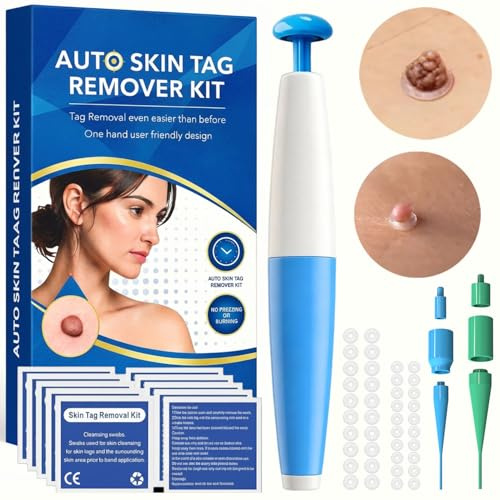 Stielwarzen Entferner, Warzenentferner-Effektiv gegen Stielwarzen für Zuhause, Skin Tag Remover, Wirksam, Sicher & Einfach ohne Chemie, Ideal für Hals, Achseln, Körper Alle Körperteile