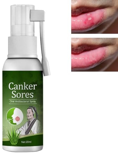 Spray de Soulagement Ulcères,Spray Ulcères de la Bouche,Spray de Soulagement des Aphtes,Spray Pour Ulceres Buccaux,Soulagement De La Douleur Buccale,Spray Traitement des Ulcères