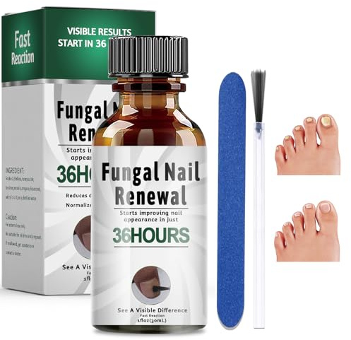 30ml Reparadores de Uñas Solución, Para Reparación En Las Uñas De Los Pies, Fortalece La Estructura De La Uña,Estaura El Aspecto De Las Uñas, Protege Las Uñas Frágiles y Dañadas