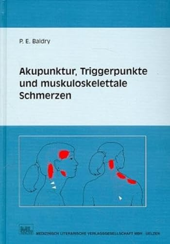 Akupunktur, Triggerpunkte und muskoskelettale Schmerzen: Eine an der westlichen Schulmedizin orientierte Form der Akupunktur für Ärzte und ... Behandlung myofaszialer Triggerpunktschmerzen