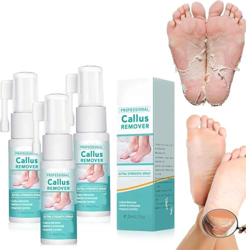 Lot de 3 sprays professionnels pour éliminer les callosités et callosités des pieds