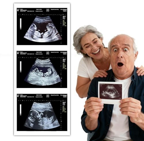 Fake Pregnancy Positive Ultrasound Personalized Prank Ultrasound for Practical Joke Pranks Funny Sonogram Reports Gag Gift & Joke Item for Adults, Gag Props，Novelty items (Twin 12 weeks)