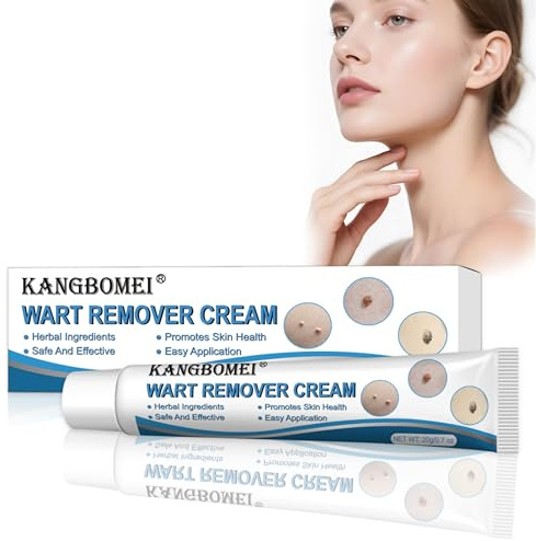 Crème anti-verrues, kit d'élimination des acrochordons, convient aux mains et aux pieds (20g)