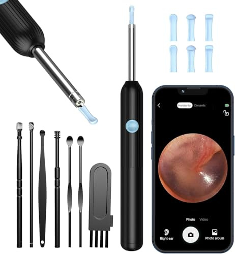 VITCOCO Ear Wax Removal Kit, Ear Cleaner with Camera 1080P Ear Wax Remover Tool, WiFi Otoscope with 6 LED Lights & 8 Ear Spoons, Ear Cleaner for iPhone iPad Android Adults Kids Pets