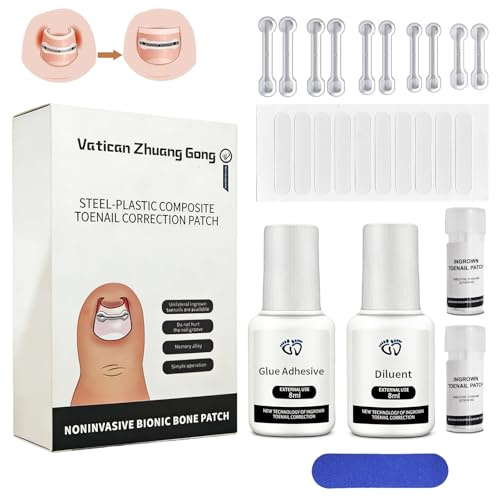 Set para Uñas Encarnadas,kit de uñas,corrector uñas encarnadas,10Pcs corrector uñas encarnadas,curva de 180° y rebote de aleación de memoria,16/17/18/19/20 mm