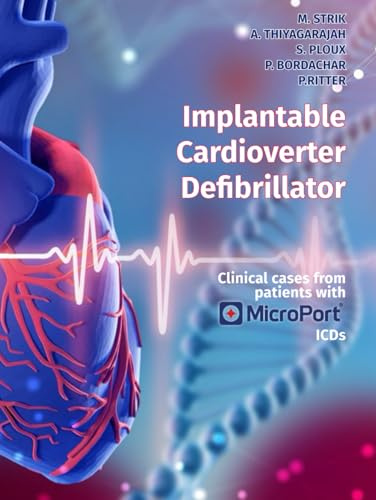 Implantable Cardioverter Defibrillator: Clinical cases from patient implanted with MicroPort ICDs