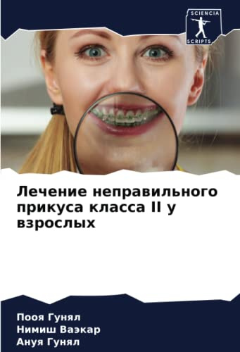 Лечение неправильного прикуса класса II у взрослых: DE