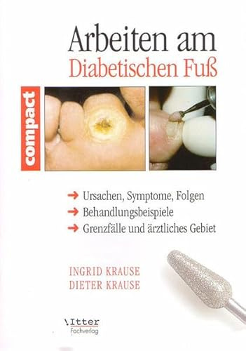 Arbeiten am Diabetischen Fuß