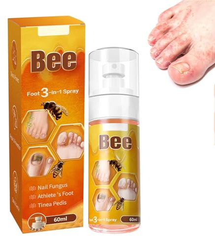 Nail Oil Mycosis Care For Nail Mycosis Foot Mycosis,Per trattamento fungine delle unghie, extra forte,per trattare e prevenire funghi delle unghie dei piedi
