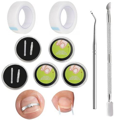 Kit de Tratamiento para Uñas Encarnadas del Dedo Gordo | Profesional de Corrección de Uñas Encarnadas, Kit de Tratamiento de Corrección de Uñas Encarnadas del
