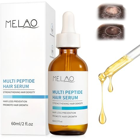 Siero Crescita Capelli, Fluido per la Crescita dei Capelli, Promuove la Crescita e la Densità, Nutre il Cuoio Capelluto, Adatto a Tutti i Tipi di Capelli, Adatto a Uomini e Donne