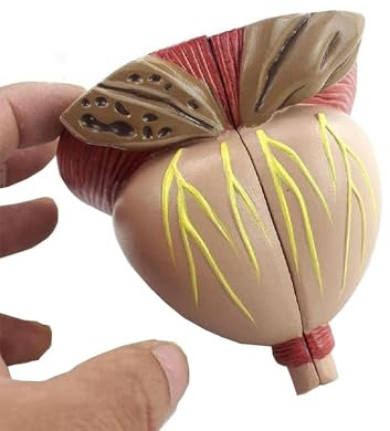 2X anatomisk modell av prostatakörteln – manlig prostatamodell, avtagbar 4-delad modell – medicinsk modell för undervisning och demonstration