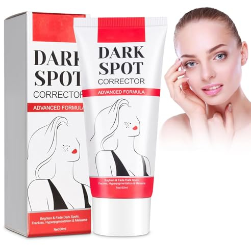 Anti Macchie Crema,Schiarente Viso,Anti-Lentiggini,Crema Per La Rimozione Delle Macchie Scure Crema Smacchiatore Per Macchie Scure,Riduce Il Melasma,Le Lentiggini e Le Macchie Solari (RED, S)