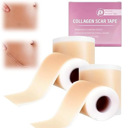 Silikonpflaster für Narben, Professionell für Narben Durch C-Sektion, Operationen, Verbrennungen, Keloid, Akne und mehr, Medikamentenfrei, Silikon-Narbenrolle (2PCS)