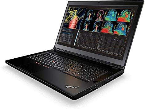 Lenovo ThinkPad P71 Mobile Workstation Laptop - Windows 10 Pro - Intel Xeon E3-1505M, 32GB RAM, 1TB SSD, 17.3 FHD IPS 1920x1080 Display, NVIDIA Quadro P3000 6GB GPU, Color Sensor, DVD±RW, SmartCard