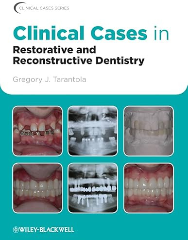 Clinical Cases in Restorative and Reconstructive Dentistry (Clinical Cases (Dentistry))