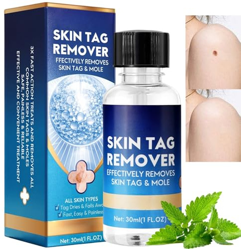 30ml Skin Tag Remover Serum,Deep Verruca Removal,Fast Acting & Painless Wart Remove,Skin Tag Remover Freeze Off,Skin Tag Remove for Hands and Body,Natural Removal without Leaving Traces,Non-Irritating