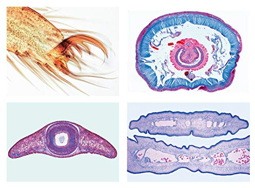 LIEDER Mikropräparat Serie: Wirbellose Tiere (Invertebrata), Grundserie - 25 Präparate