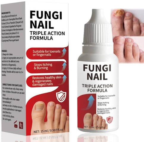 Fungal Nail Treatment Extra Strong Toenail Fungus Treatment – Repair & Revitalize Damaged, Discolored Nails for Healthier, Clearer Toenails. Fast-Acting Formula for Lasting Results