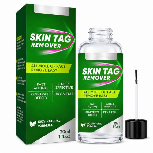 Verruche Rimozione, Skin Tag Remover, Adatto a Diversi Tipi di Pelle, Elimina-Calli Delicato per Piedi Lisci e Sani, 30 ml